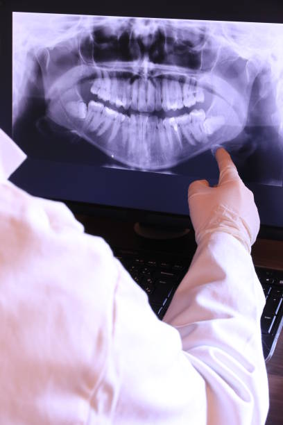 Best Dentist for Tooth Abscess  in Nephi, UT