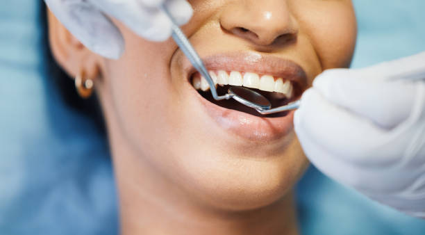 Best Affordable Emergency Dental Care  in Nephi, UT